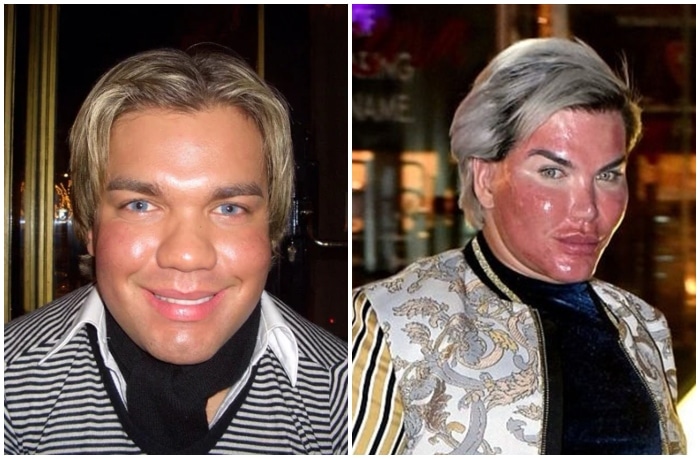 Rodrigo Alves showcases the results of her latest surgery in a